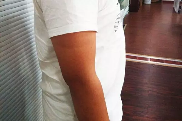 為什麼女性過了40歲,容易發胖?
